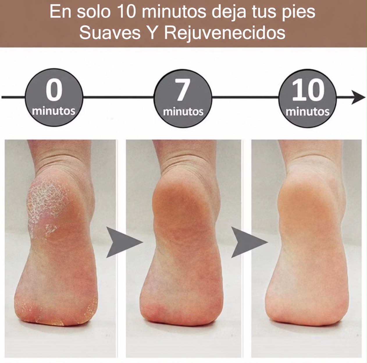 Lijador de pies eléctrico – Exfoliador para eliminar callos, pedicura portátil.